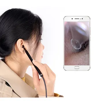 3.9 Mm Usb Kulak Kamera Otoskop HD Kulak Kapsam Endoskop Görsel Kulak Endoskop Kulak Kirini İle Uyumlu Kulak Temizleyici Android İçin